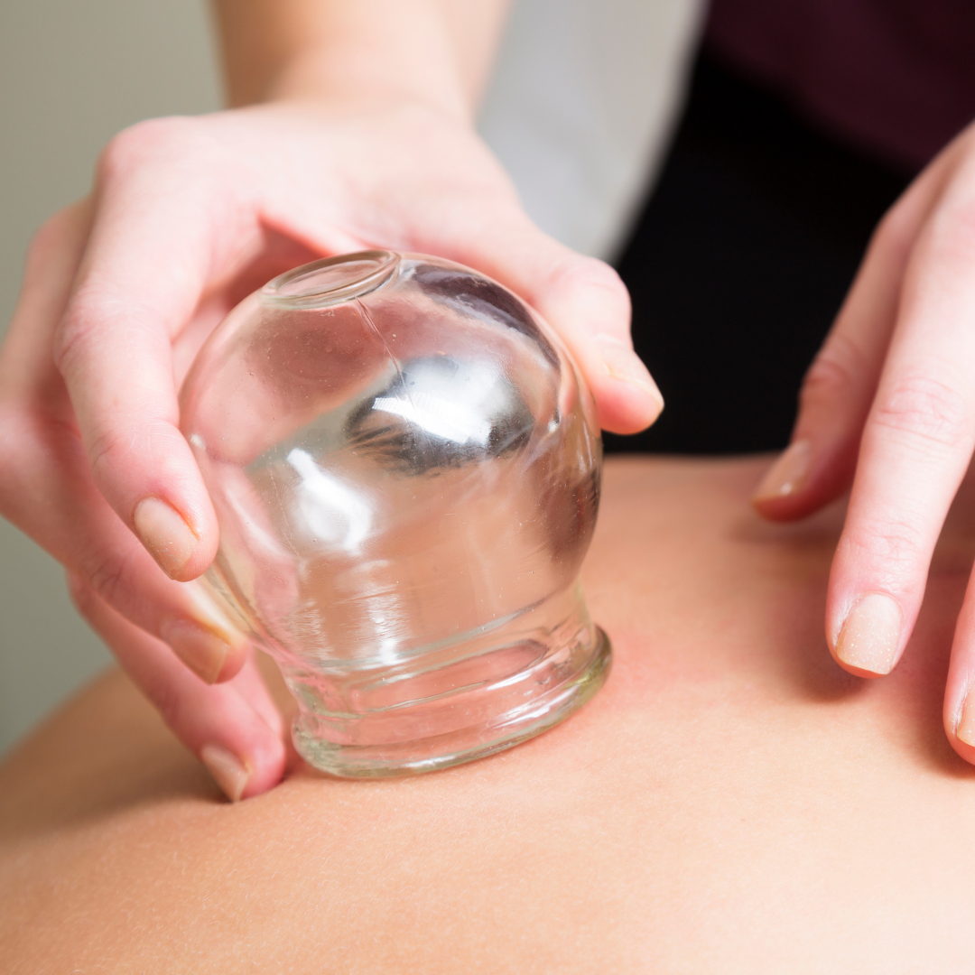 person getting myofascial cupping massage therapy done on their back