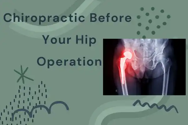 Featured Image for “Seeing a Chiropractor Before Hip Replacement Surgery?”