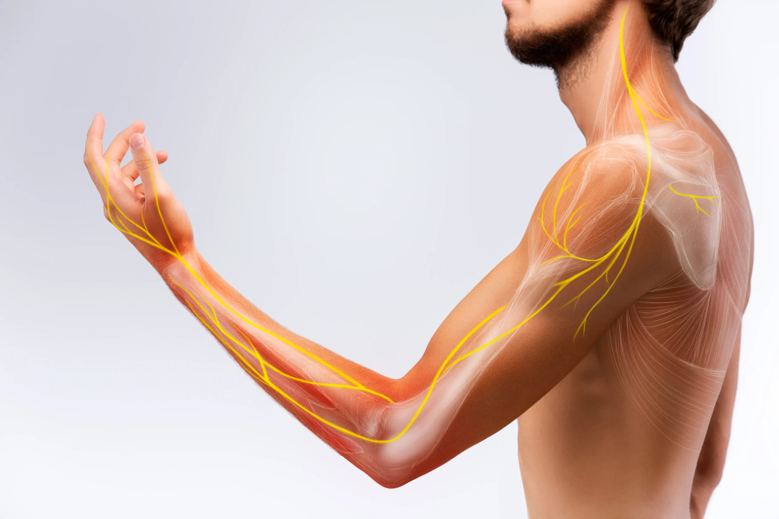 Man With Nerve Pain in arm