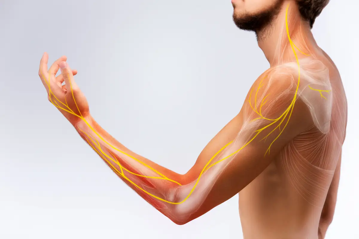 Man with nerve pain in his arm